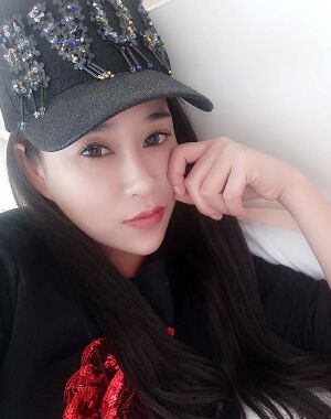 牛永敢做的隆鼻失敗修復(fù)，對(duì)比很明X哦~