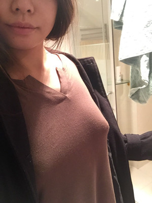 大家看看自體脂肪隆胸恢復(fù)果圖吧