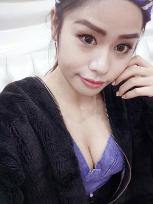 大家看看自體脂肪隆胸恢復(fù)果圖吧