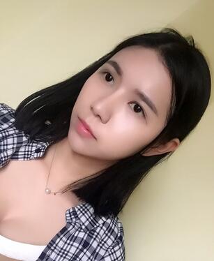 自體脂肪填充恢復日志 自體脂肪填充太陽穴+額頭