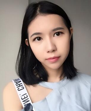 自體脂肪填充恢復日志 自體脂肪填充太陽穴+額頭