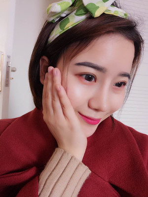 隆鼻整形前后對比變化真的不要太大哦