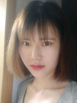 隆鼻整形真實恢復(fù)期圖片，大鼻子終于變秀氣了