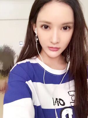 面部埋埋蛋白線.提升術(shù)后照片，皮膚緊致不少了