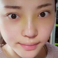 假體隆鼻15天后恢復圖，隆鼻果自然