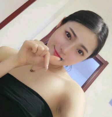 假體隆鼻15天后恢復(fù)圖，隆鼻果自然