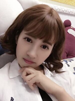 切開雙眼皮恢復(fù)過程，手術(shù)很成功哦