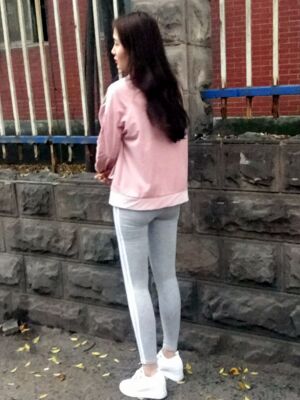 大腿吸脂果超好，腿型好看很多了