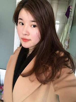 做了詳細(xì)部脂肪填充+雙眼皮+假體隆鼻，來看看果如何