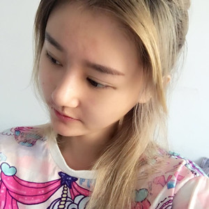 硅膠隆鼻2個(gè)月啦，8000元做的哦!