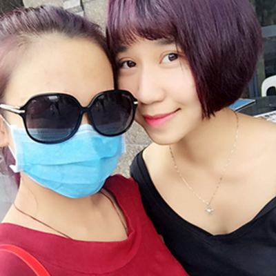 南京華美曹海峰雙眼皮案例