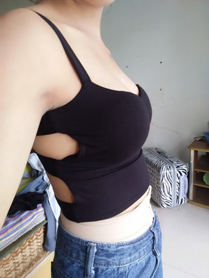 做完自體脂肪豐胸手術(shù)3個(gè)月啦!來(lái)看看前后對(duì)比照片哦