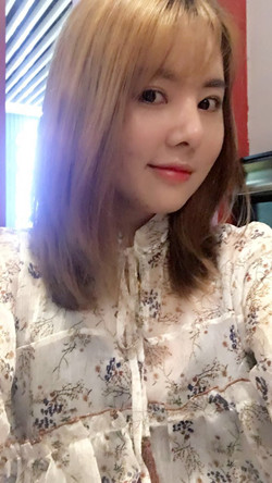 歪鼻矯正+假體隆鼻前后手術(shù)過(guò)程圖片分享