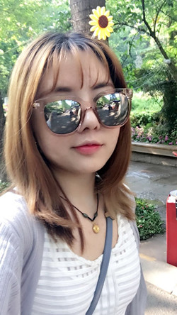 歪鼻矯正+假體隆鼻前后手術(shù)過(guò)程圖片分享