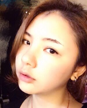 韓式定點雙眼皮前后對比圖，雙眼有神多了