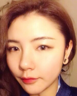 韓式定點雙眼皮前后對比圖，雙眼有神多了