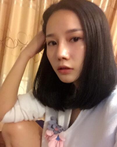 隆鼻整形真實(shí)恢經(jīng)歷 曬圖啦！