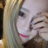 玻尿酸填充臥蠶果對比圖，很滿意