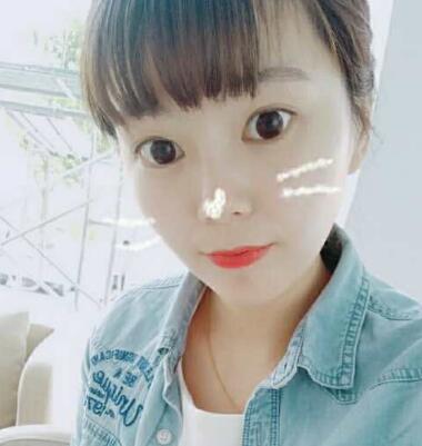 做完光子嫩膚恢復(fù)圖片和過程分享，光子嫩膚價格3800元