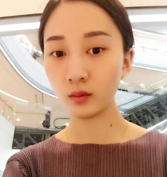 有誰(shuí)做過(guò)激光祛雀斑?個(gè)人激光祛雀斑后恢復(fù)日記分享