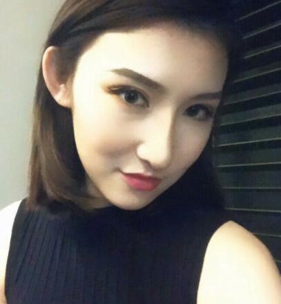 隆鼻失敗修復(fù)后恢復(fù)圖分享,鼻子修復(fù)價(jià)格9800元