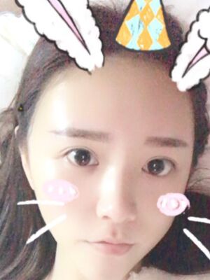 自體脂肪詳細(xì)部填充日記，恢復(fù)過程分享