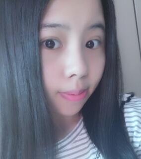 鼻部綜合整形恢復(fù)過(guò)程圖分享