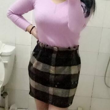 吸脂減肥瘦腰腹不反彈，恢復(fù)過(guò)程圖分享