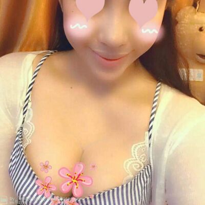 自體脂肪豐胸對比照片，福州愛美爾張勝利做的