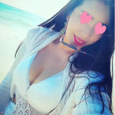 自體脂肪豐胸對比照片，福州愛美爾張勝利做的