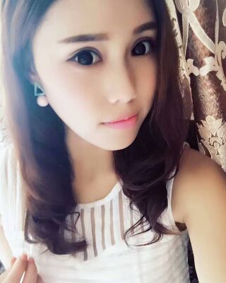 雙眼皮失敗修復(fù)果圖，福州愛美爾王召克做的