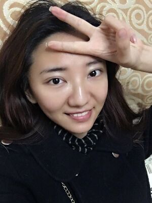 激光祛痘恢復(fù)過程圖，福州愛美爾做的喲