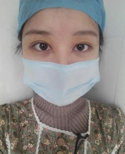 見證全切雙眼皮使單眼皮變雙眼皮的奇跡~恢復過程圖分享