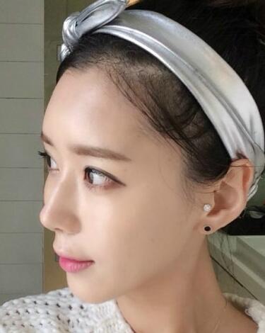 果酸嫩膚多少錢？我做成890元，果圖分享給大家