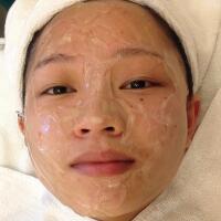 有人做過(guò)光子嫩膚嗎？自己做過(guò)，感覺(jué)果不錯(cuò)分享