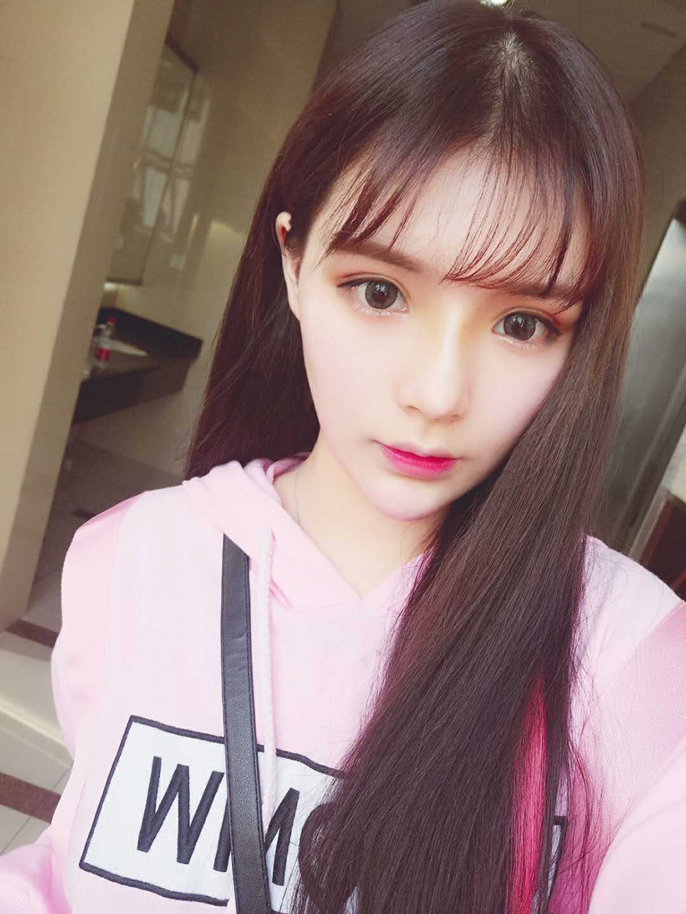 線D隆鼻果好不好，長(zhǎng)沙希美真是案例告訴你