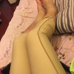 青?？等A馮相周醫(yī)生大腿抽脂案例分享