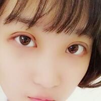 切開雙眼皮多少錢？割雙眼皮真實案例多對比圖分享