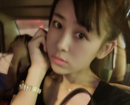 鼻翼縮小手術(shù)對(duì)比圖分享——四川悅好整形