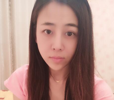 鼻翼縮小手術(shù)對(duì)比圖分享——四川悅好整形