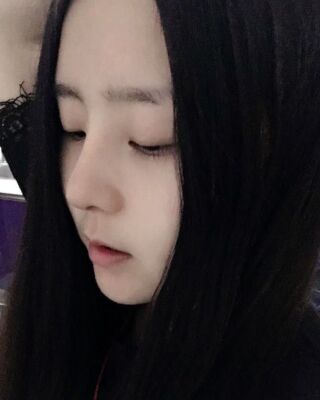 洛陽(yáng)維多利亞隆鼻整形前后對(duì)比果圖