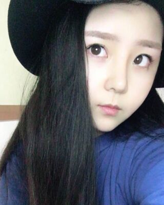 洛陽(yáng)維多利亞隆鼻整形前后對(duì)比果圖