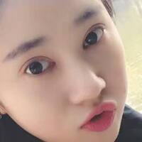 開(kāi)眼角+割雙眼皮真實(shí)案例前后對(duì)比圖分享——四川悅好整形