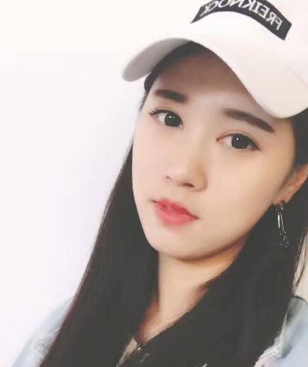 開眼角+割雙眼皮真實(shí)案例前后對(duì)比圖分享——四川悅好整形