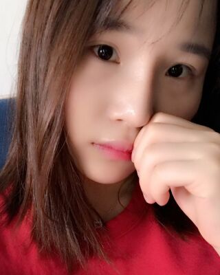 仇侃敏韓式隆鼻整形恢復(fù)果對(duì)比照片