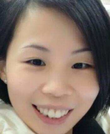 牙齒矯正的很好的年齡，多對(duì)比圖真實(shí)案例分享——成都格林口腔