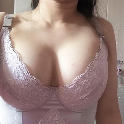 武漢憶美凱德自體脂肪經歷分享