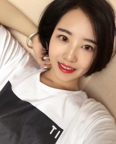 武漢憶美凱德去眼袋手術后兩個月照片