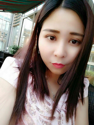 深圳南西子袁新平醫(yī)生做的割雙眼皮+開眼角前后恢復過程圖片分享