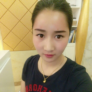 武漢美都張召醫(yī)生做的自體脂肪豐額頭+太陽穴，真實(shí)案例分享